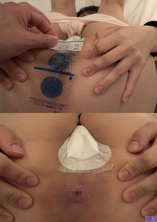 【個撮】ぎょう虫検査・オナラ・浣腸の羞恥